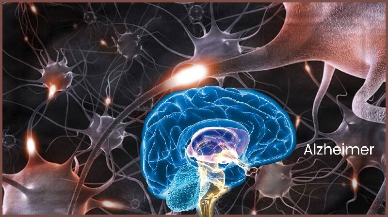 A doença de Alzheimer é transmissível?