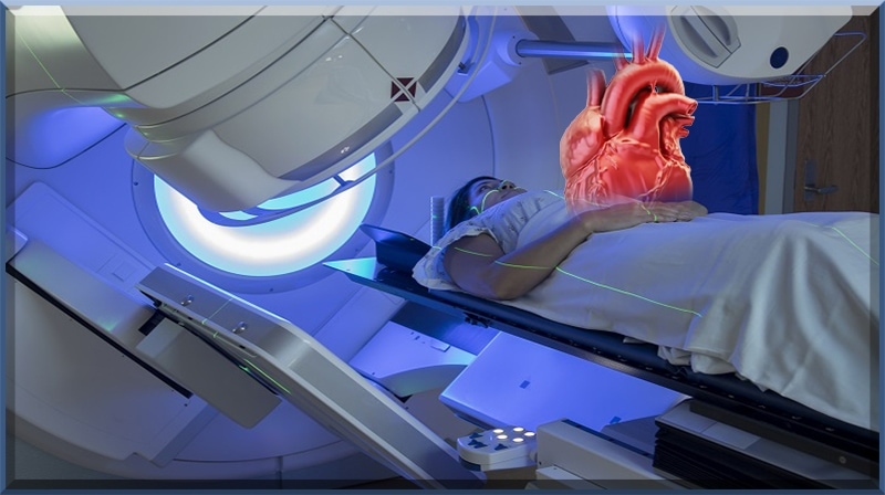 A radioterapia ativa genes que curam o coração