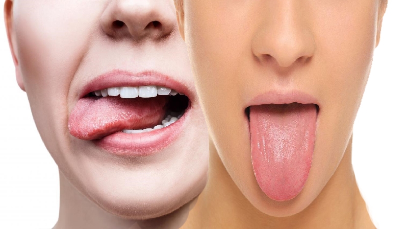 O que causa um sabor doce na boca?