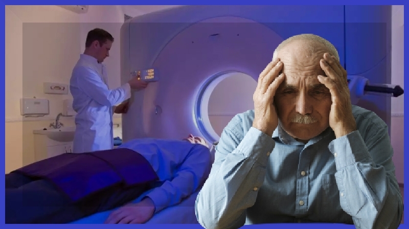 O tratamento com radiação pode aliviar os sintomas da doença de Alzheimer grave ...