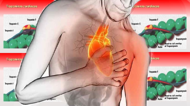 Proteína - Troponina - de ataque cardíaco pode aumentar risco de morte precoce