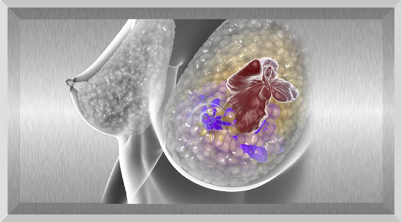 Tratamento do câncer de mama triplo negativo: composto de cardamomo mostra-se promissor
