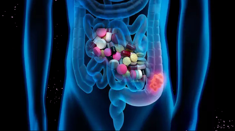 Uso de antibióticos associado ao risco de câncer de cólon em pessoas mais jovens