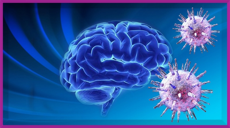 Vírus Epstein-Barr pode ser a principal causa de Esclerose Múltipla